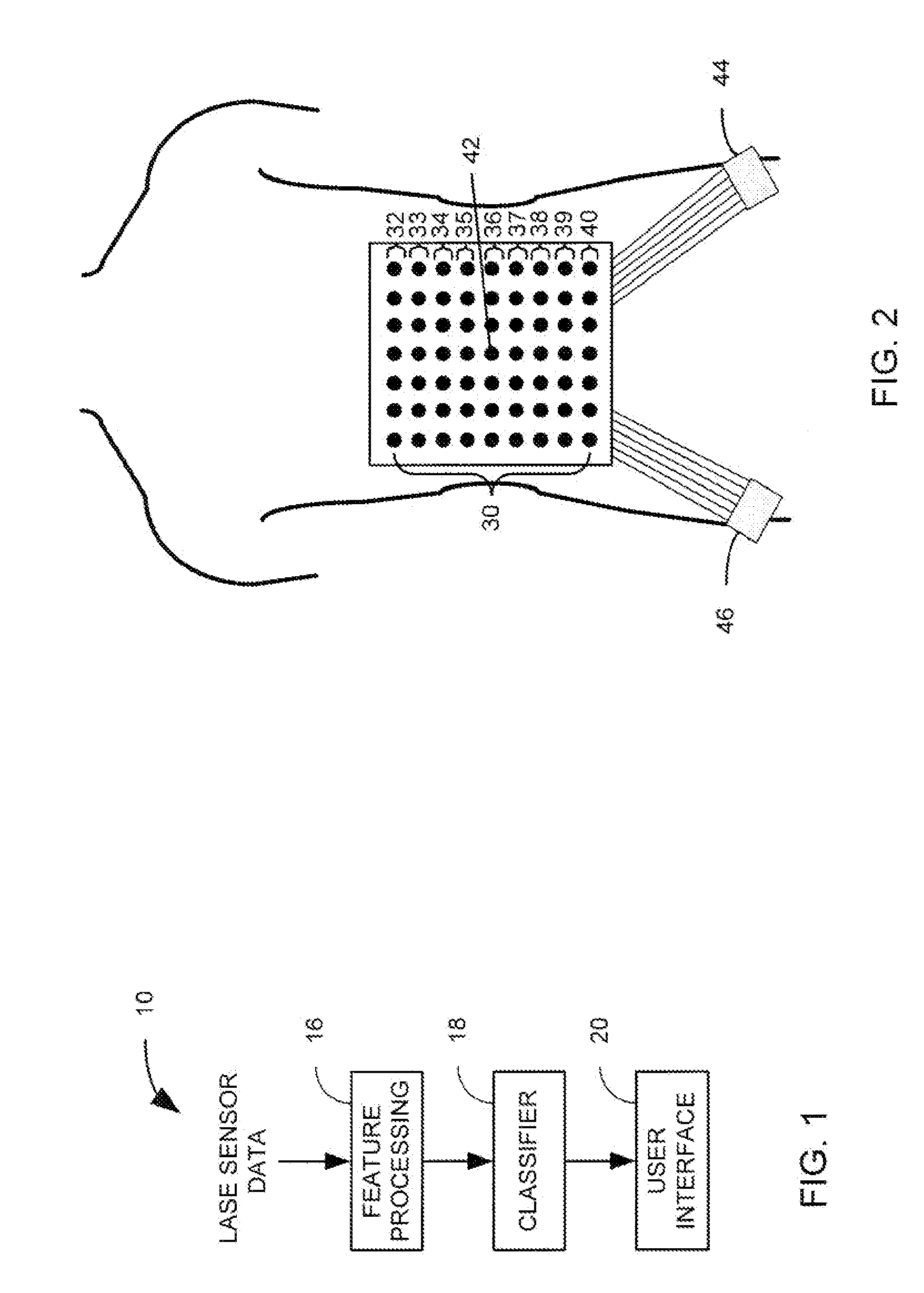 Prediction of clinical outcome using large array surface myoelectric potentials