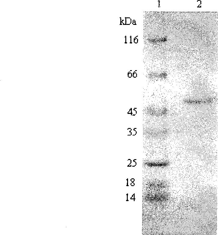 Application of corytuberine in preparing medicament for resisting Eimeria tenella