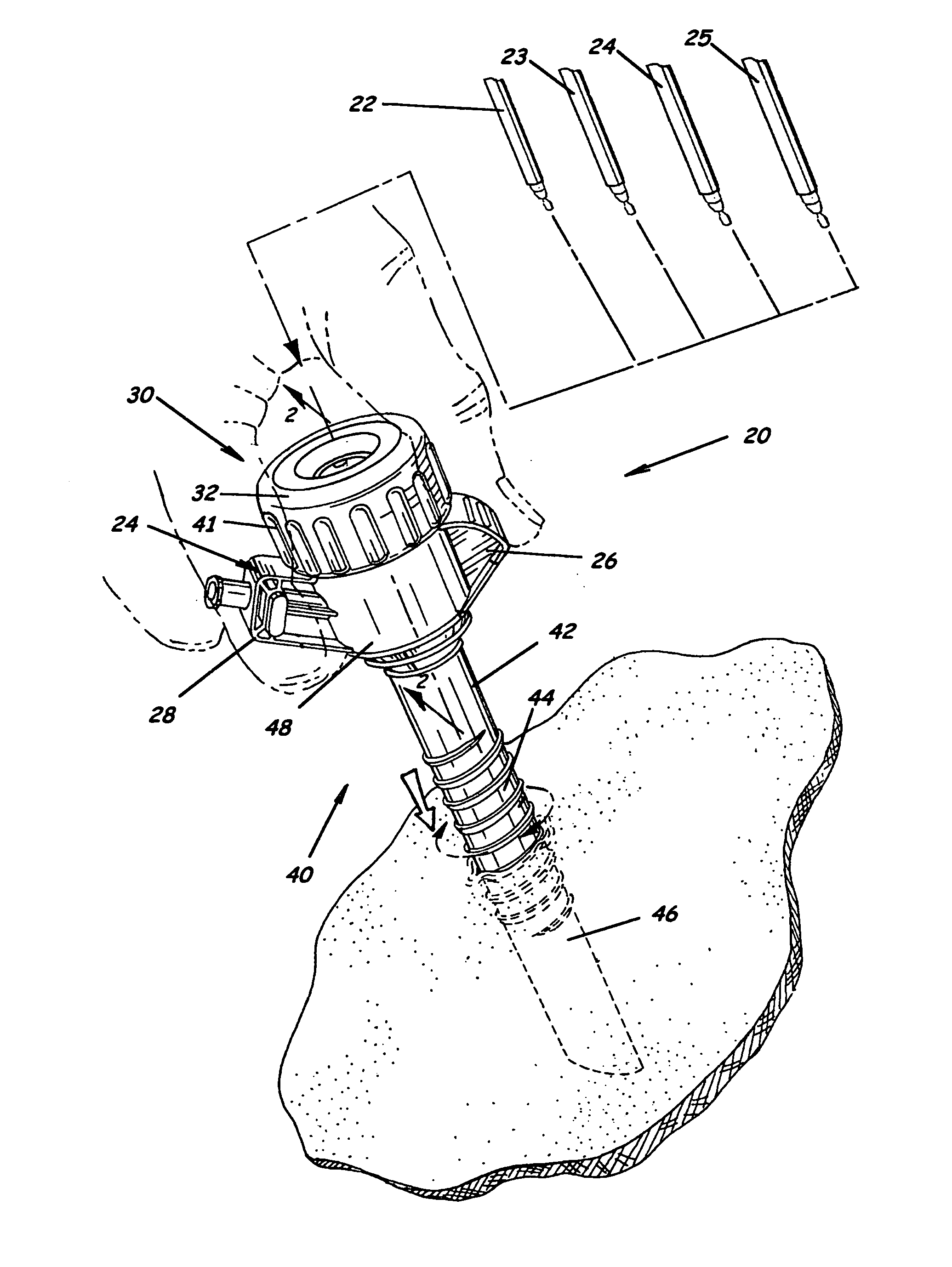 Trocar having planar fixed septum seal and related methods