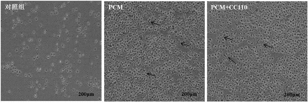 Method of amplifying hematopoietic stem cells of umbilical cord blood in vitro