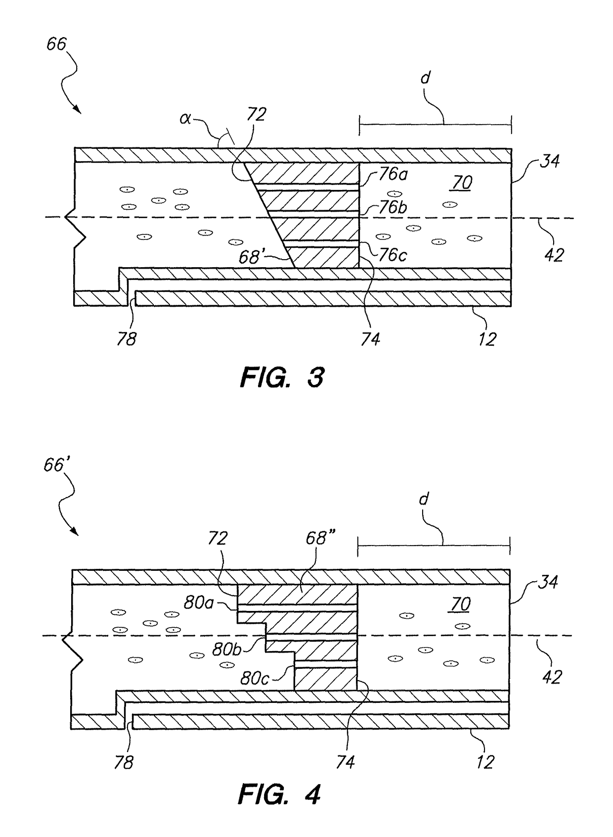 Method for infusing stem cells