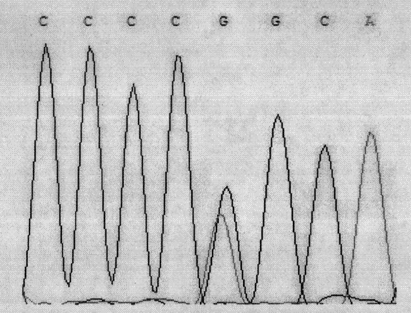 Single nucleotide polymorphism (SNP) of ADD1 gene of cattle and detection method thereof