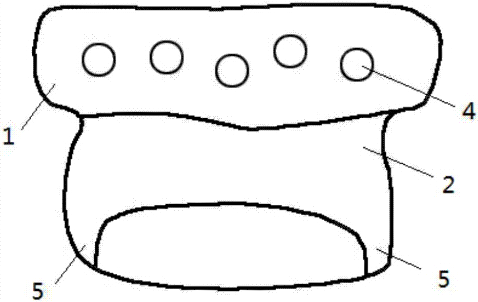 Personalized temporal-mandibular joint fossa implant