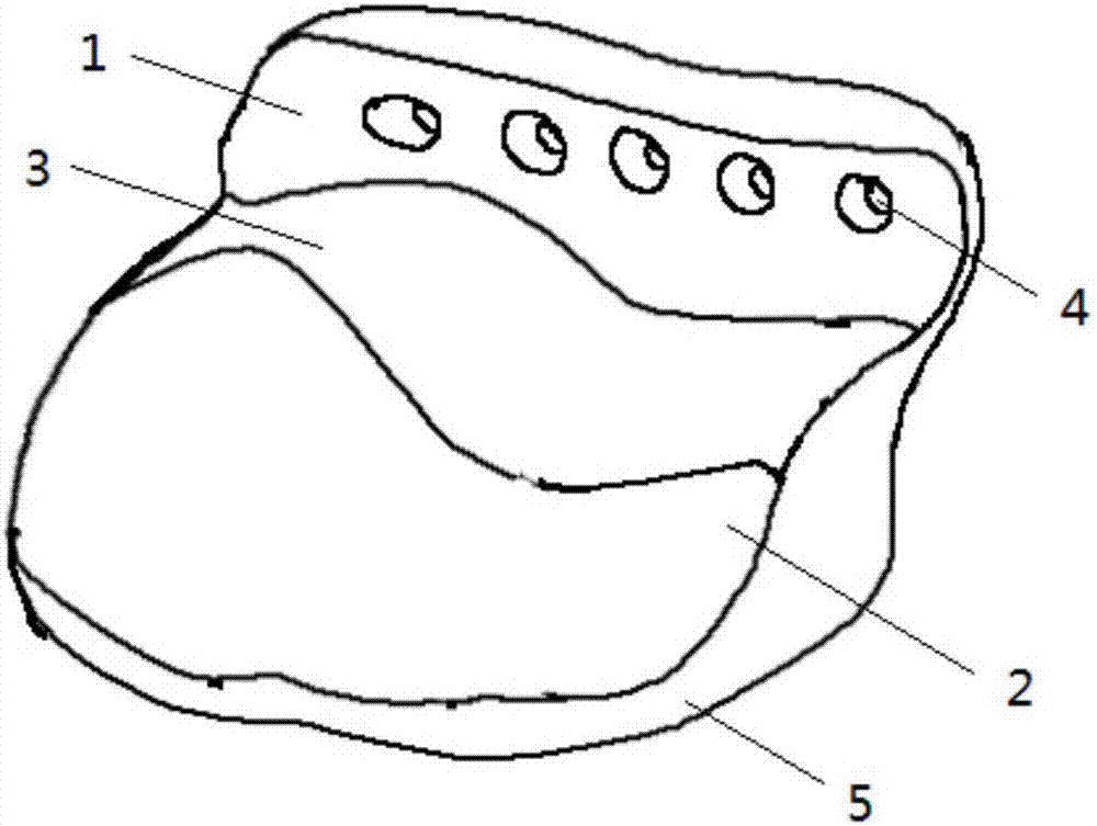 Personalized temporal-mandibular joint fossa implant