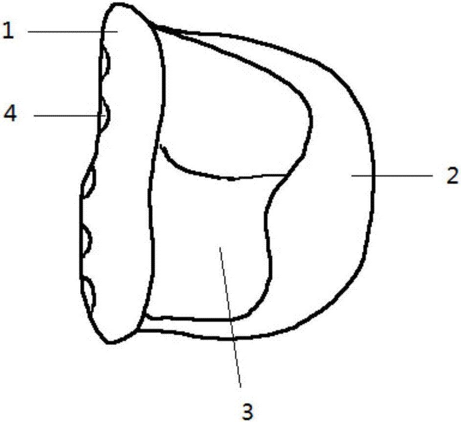 Personalized temporal-mandibular joint fossa implant