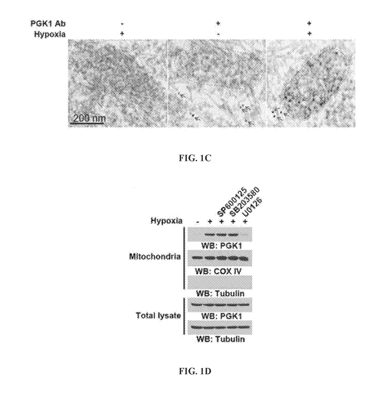 The protein kinase activity of phosphoglycerate kinase 1 as a target for cancer treatment and diagnosis