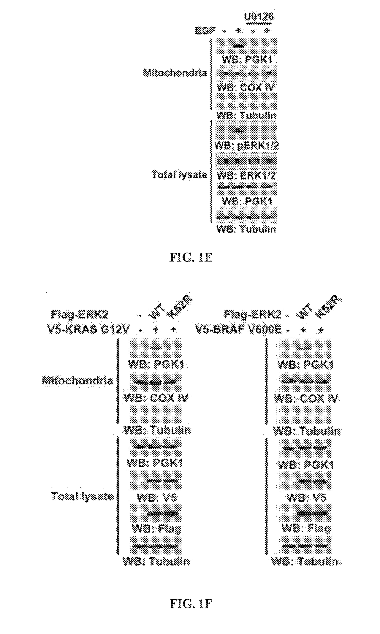 The protein kinase activity of phosphoglycerate kinase 1 as a target for cancer treatment and diagnosis