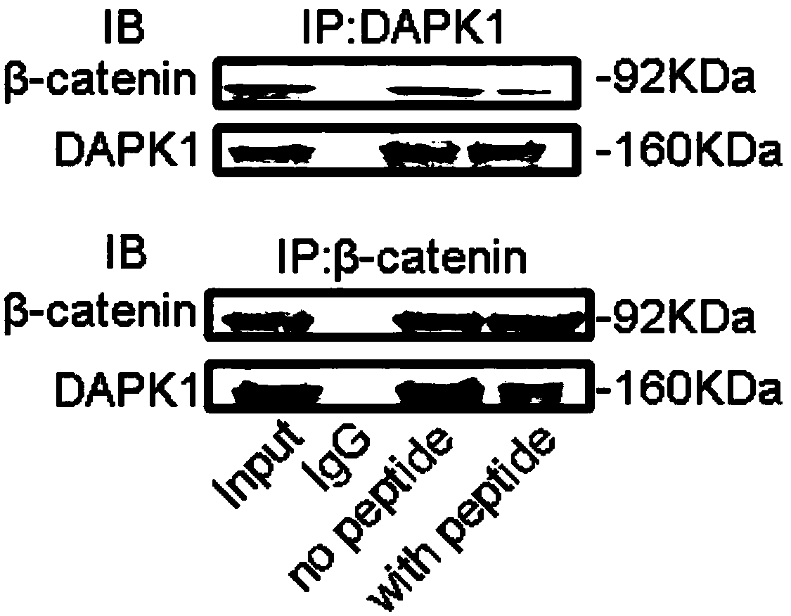 Brain-penetrating polypeptide and application thereof in preparation of medicament for preventing and treating Alzheimer's disease