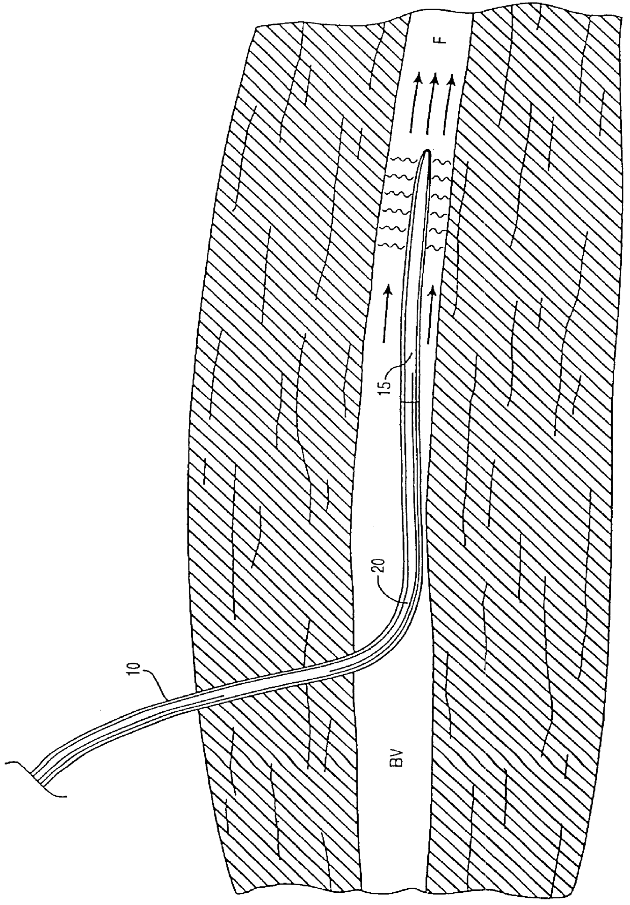 Method and apparatus for controlling a patient's body temperature by in situ blood temperature modifications