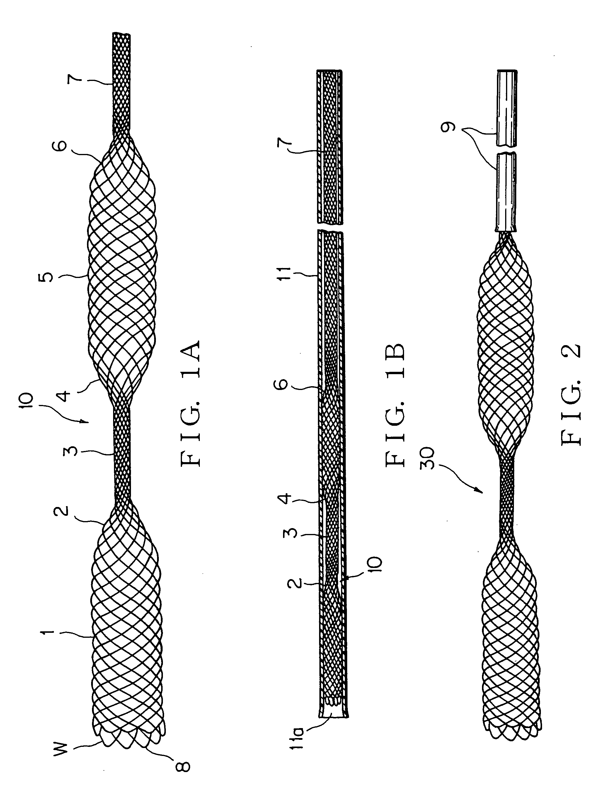 Temporary stents and stent-grafts