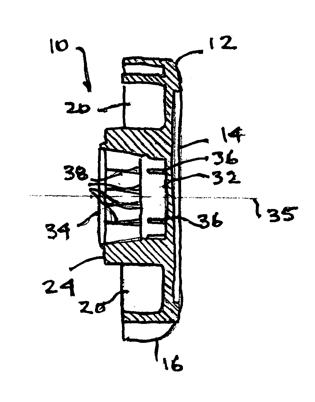 Bottle cap remover