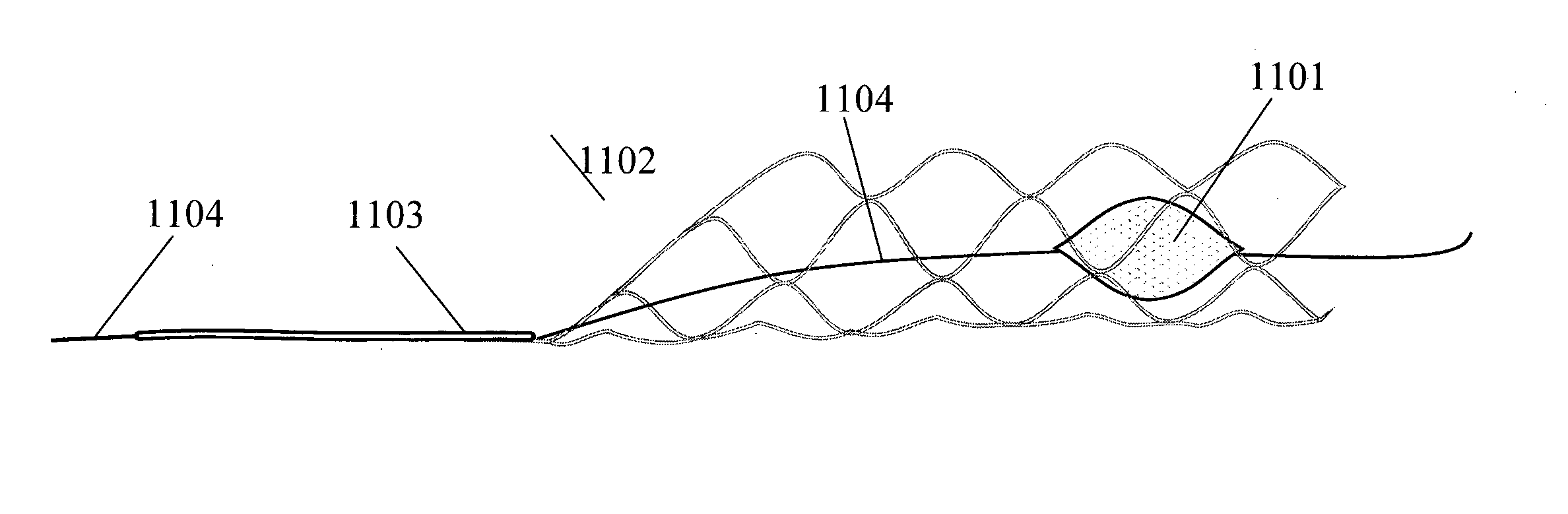 Clot retrieval device for removing occlusive clot from a blood vessel