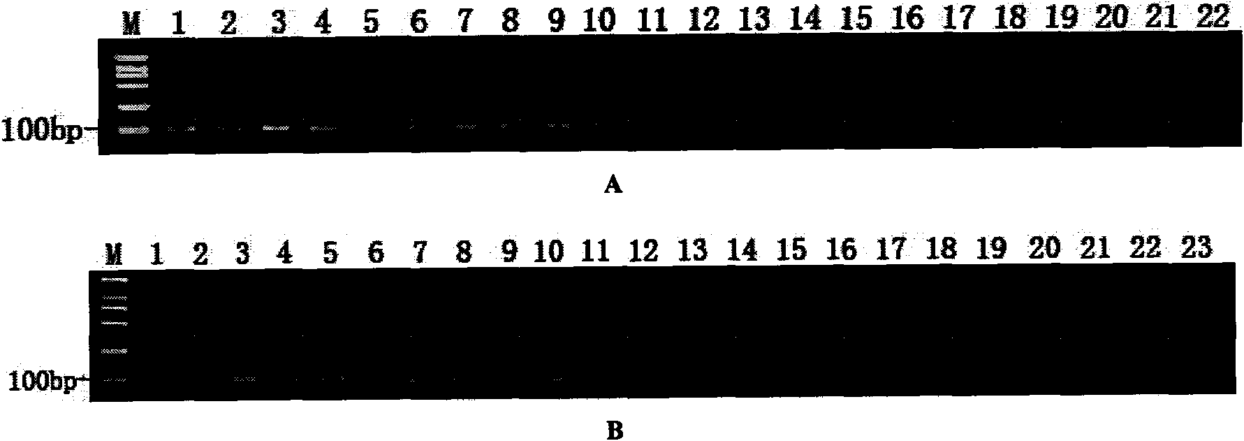 Padlock probe for detecting Xanthomonas oryzae pv. oryzae and anthomonas oryzae pv.oryzicola and multiple detection method