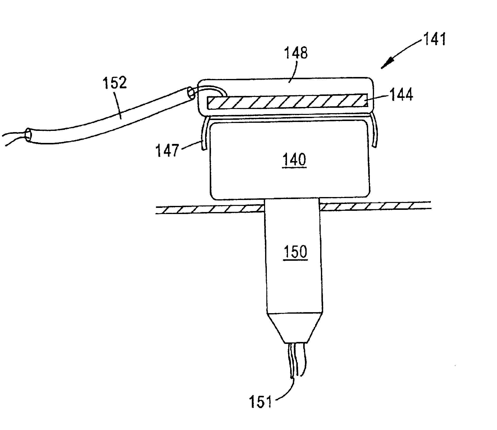 Coil on plug capacitive signal amplification and method of determining burn-time