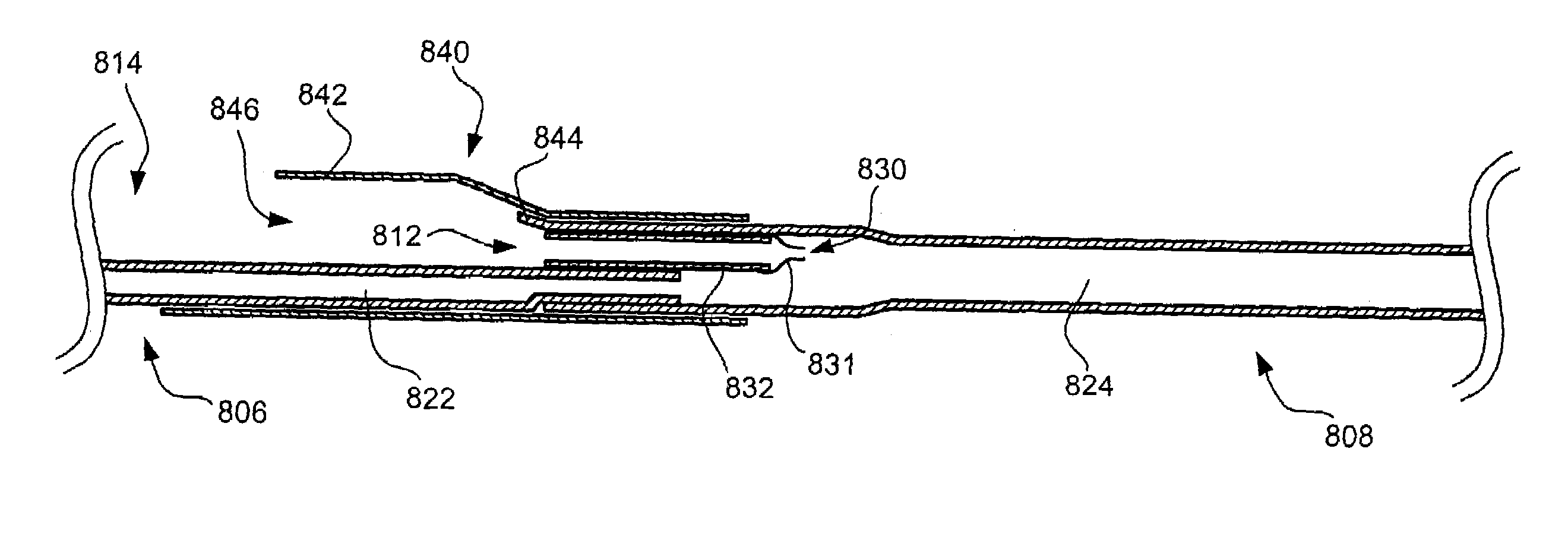 Rapid exchange catheter with detachable hood