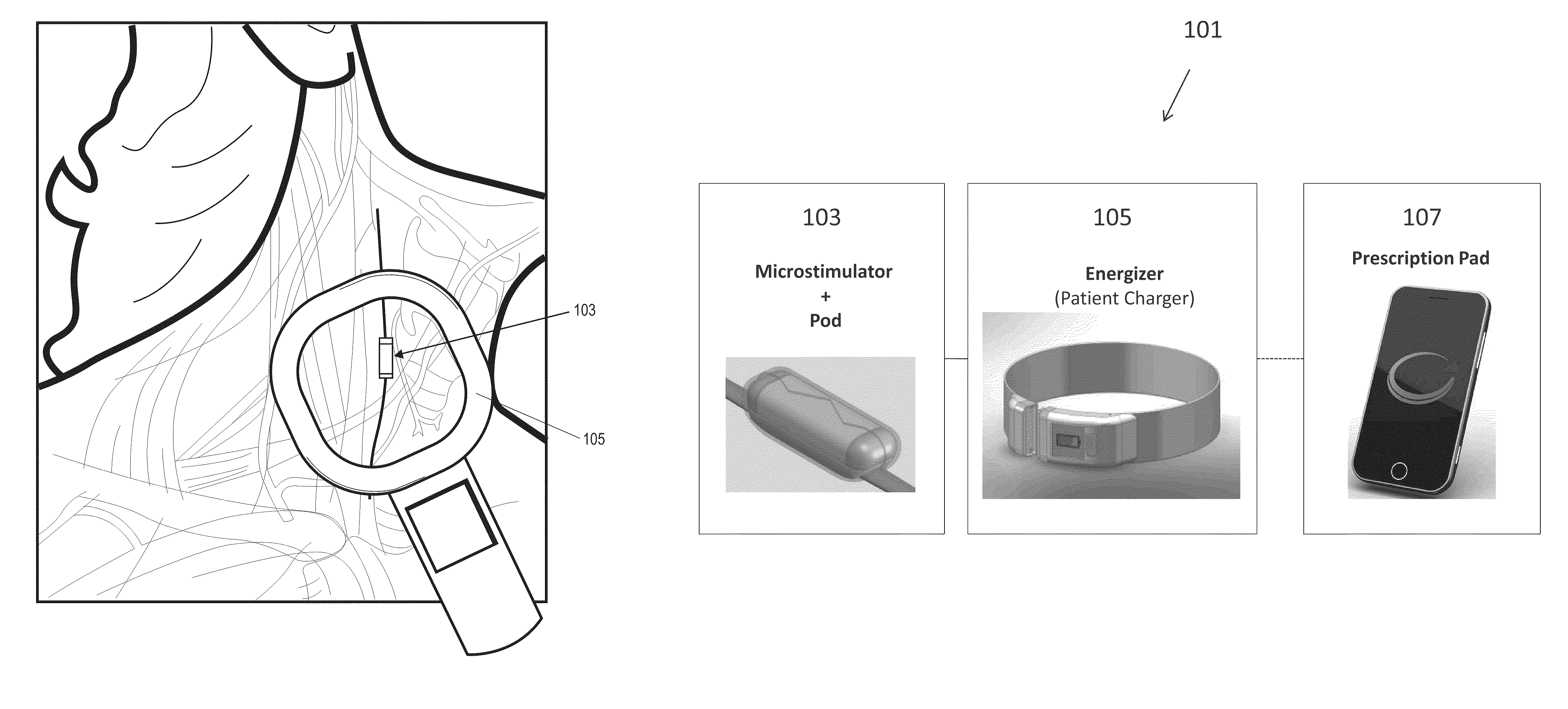 Neural stimulation devices and systems for treatment of chronic inflammation