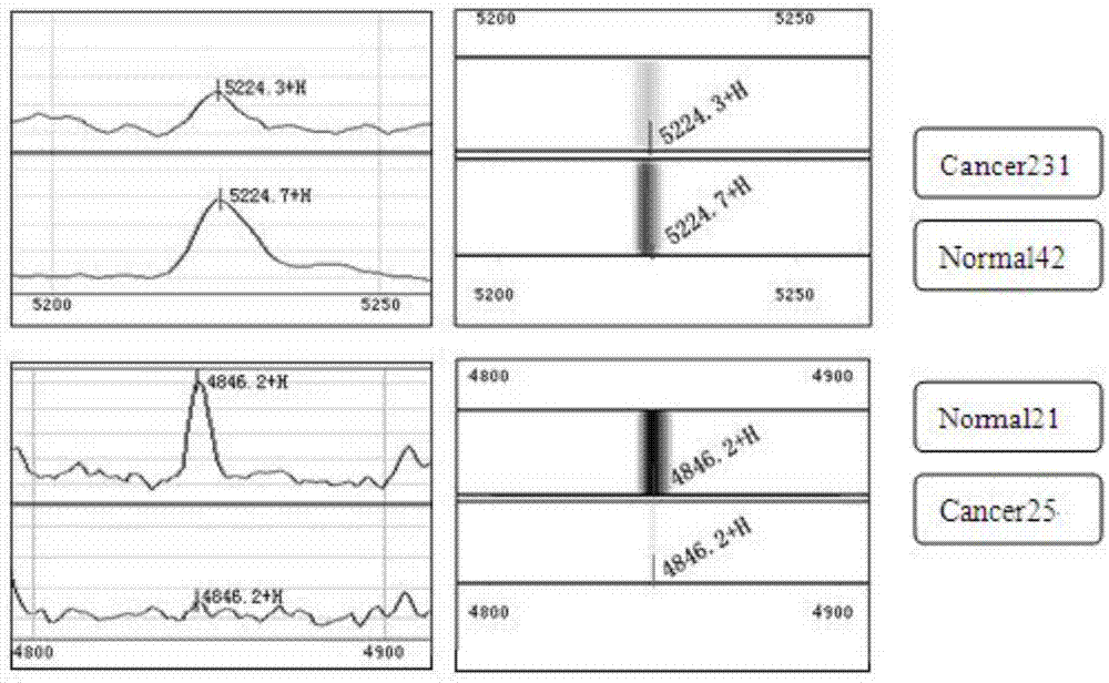 Breast cancer early stage diagnosis sialoprotein fingerprint model and construction method thereof