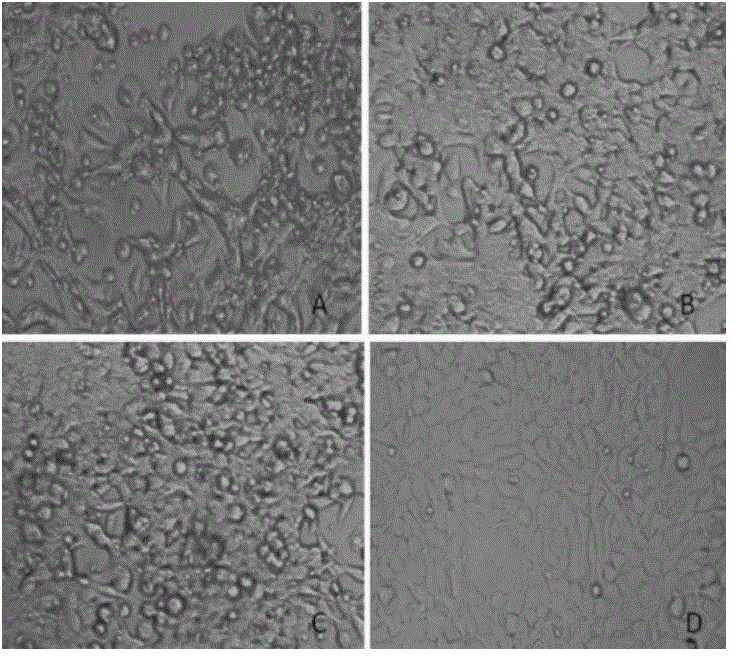 Recombinant adenovirus for expression of goat alpha interferon and construction method and application thereof