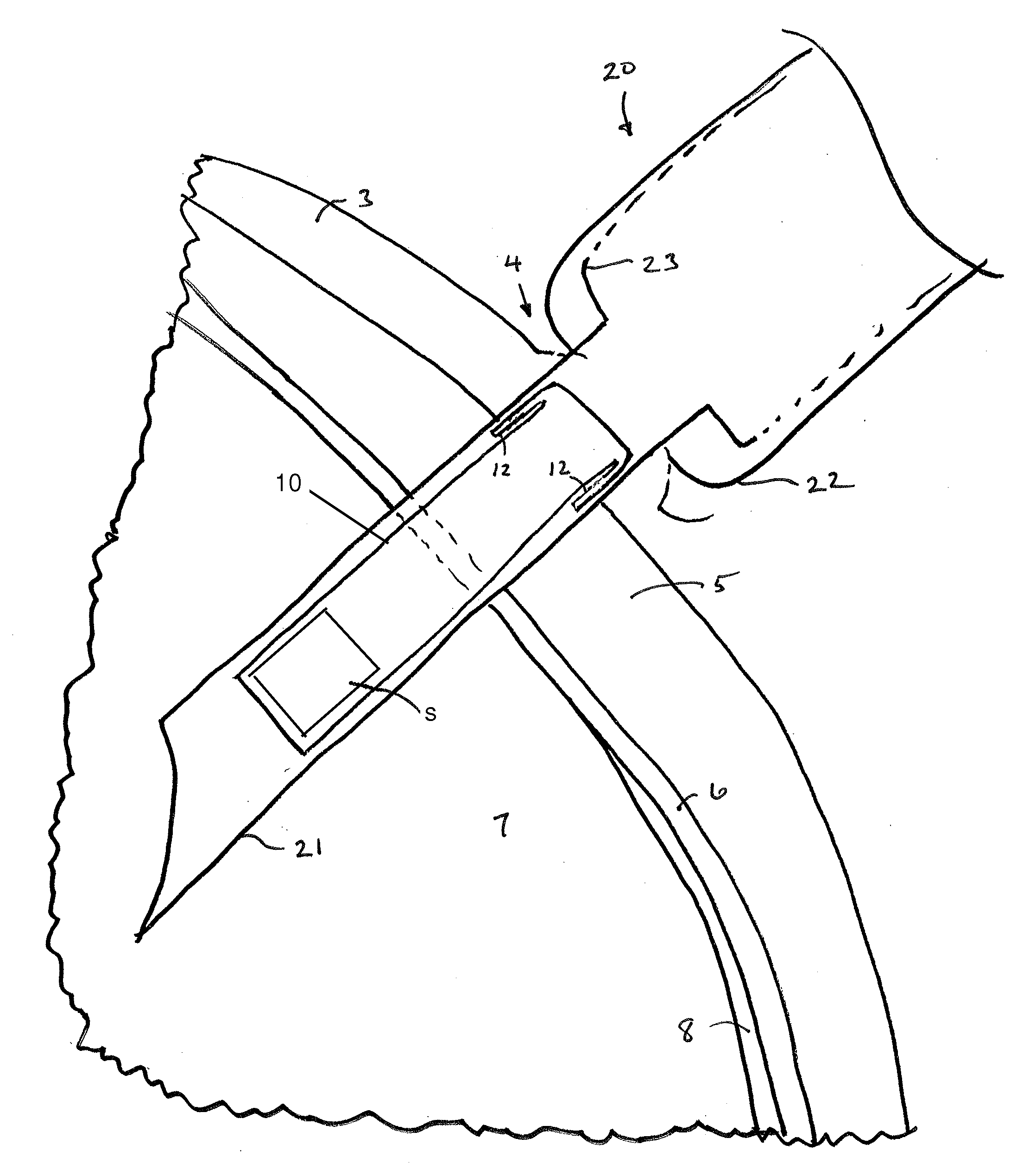 Methods and devices for implantation of intraocular pressure sensors