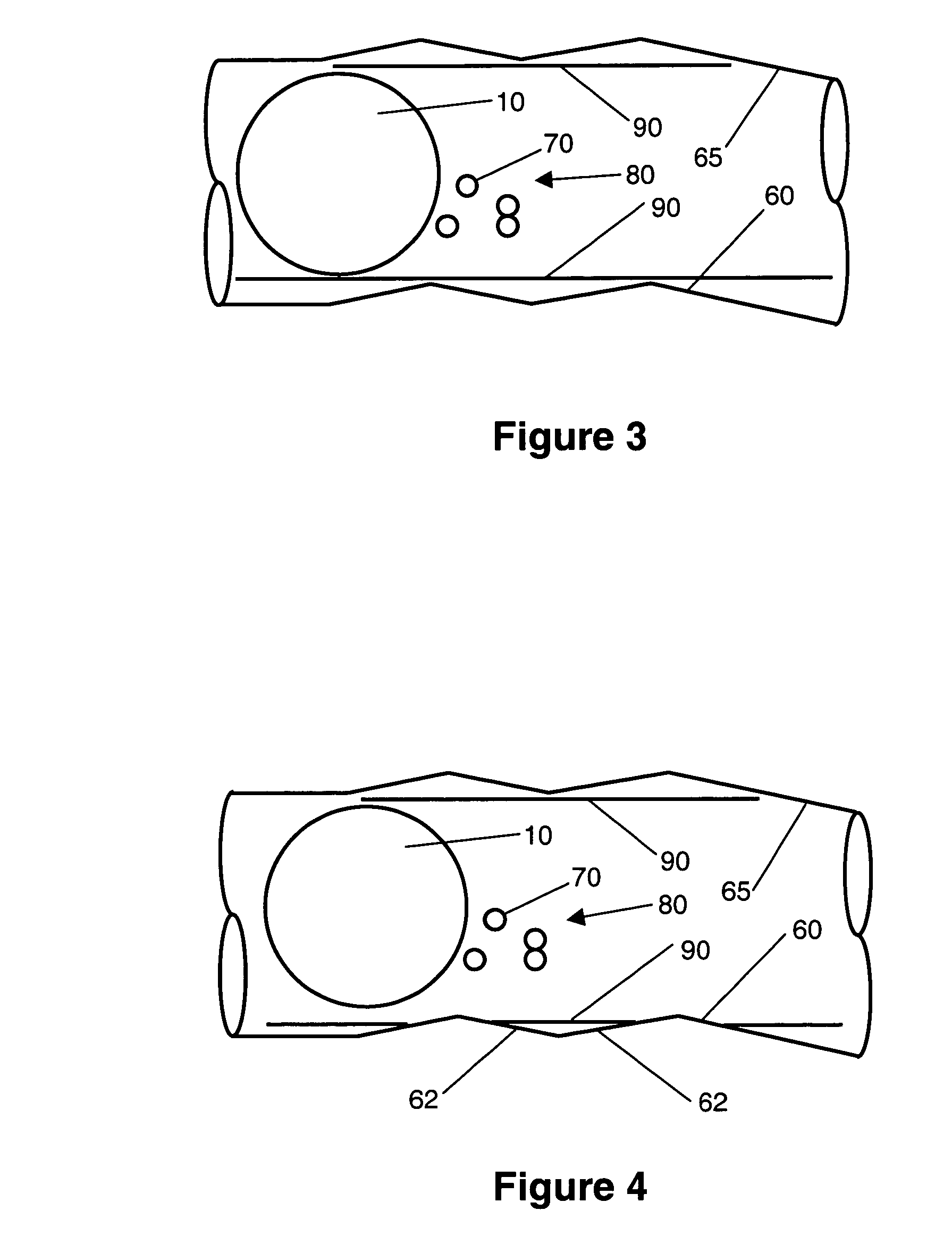 Bearing having anodic nanoparticle lubricant