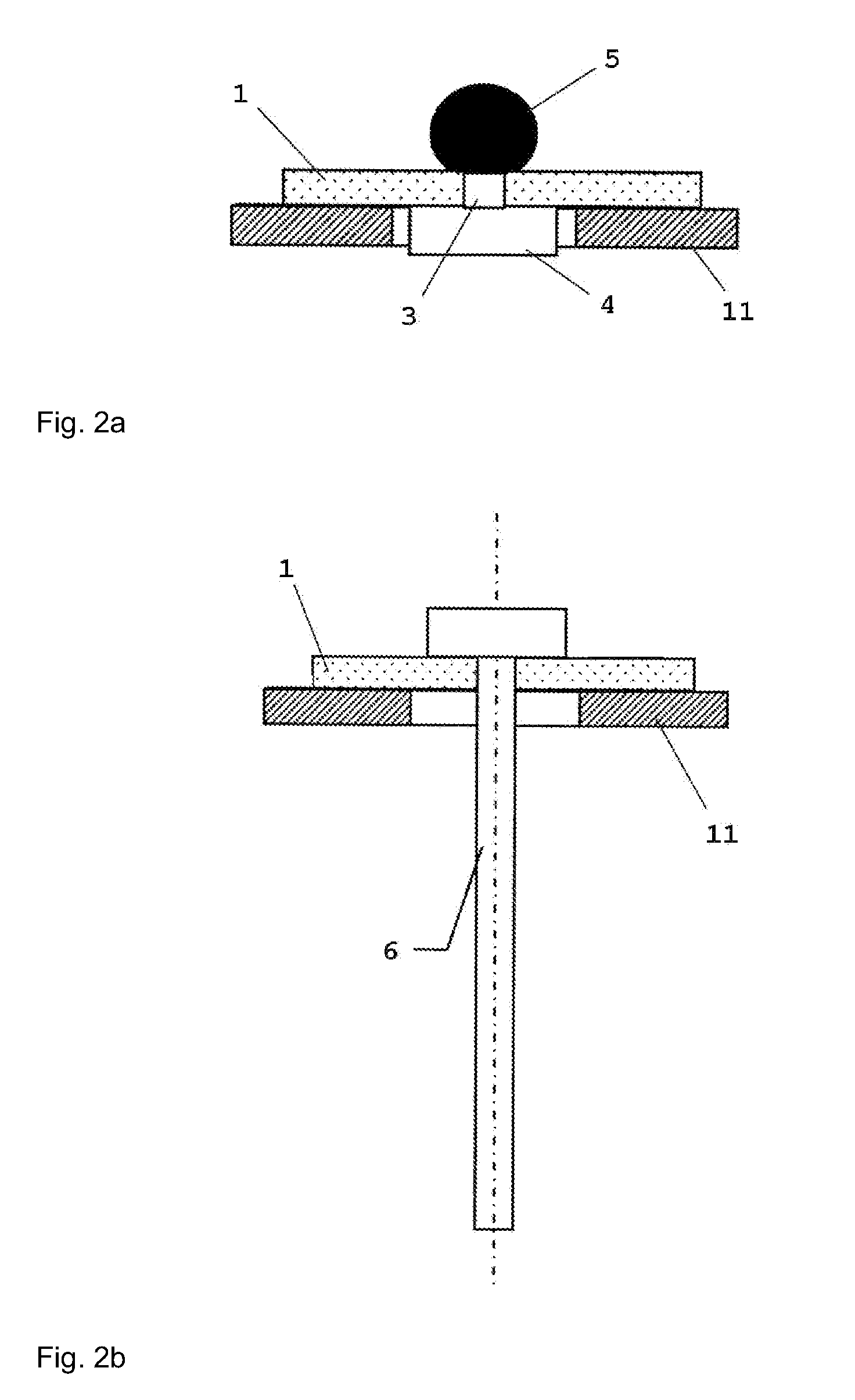 Filter feedthrough for implants