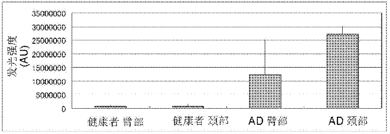 Check method of atopic dermatitis