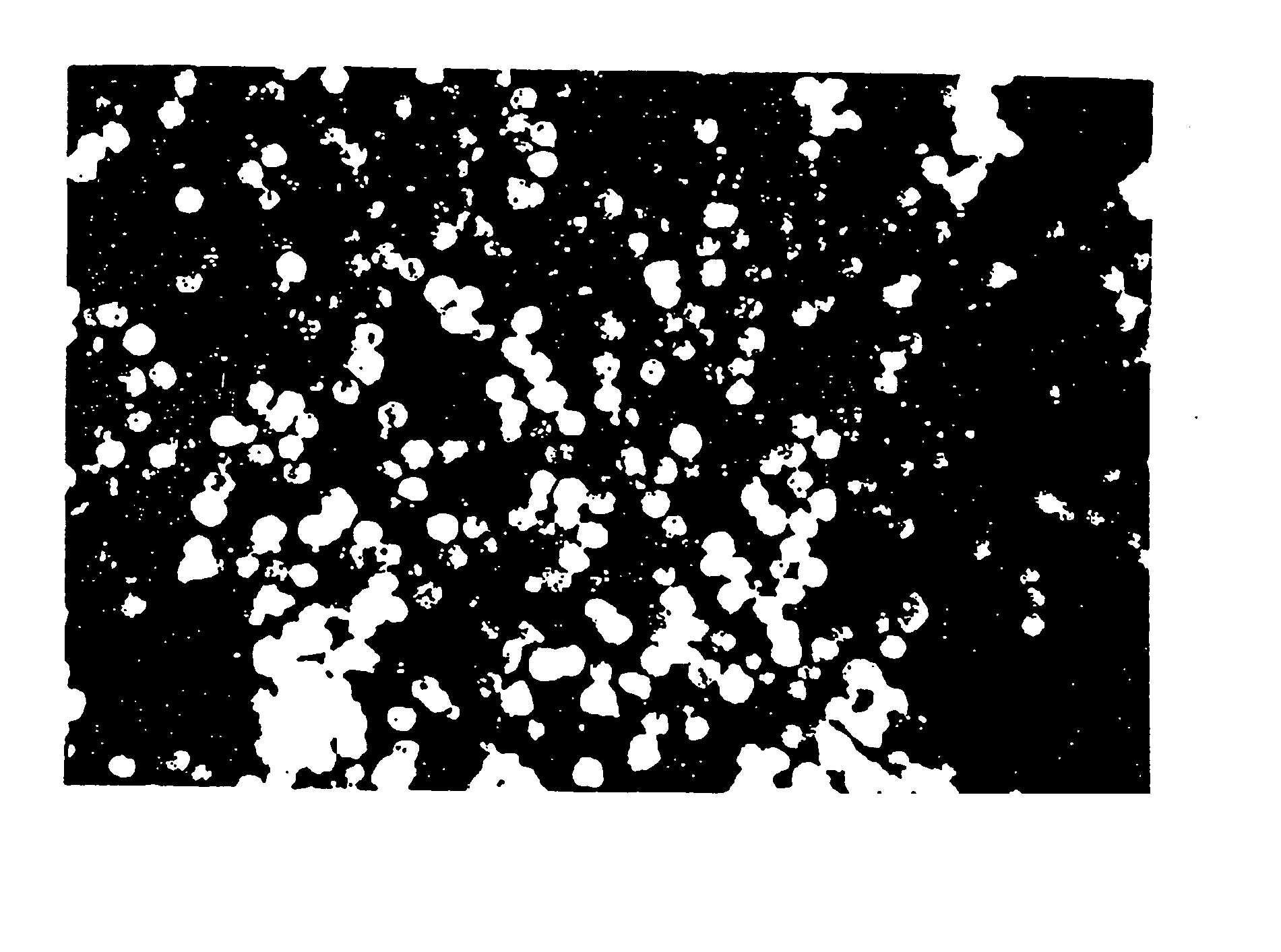 Tissue augmentation material and method