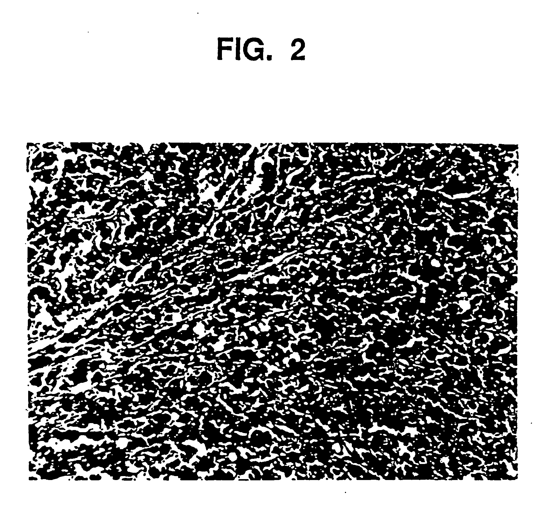 Tissue augmentation material and method