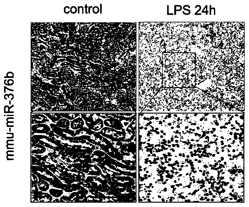 Application of miR-376b and detection kit