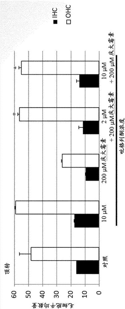 Method of preventing or treating hearing loss