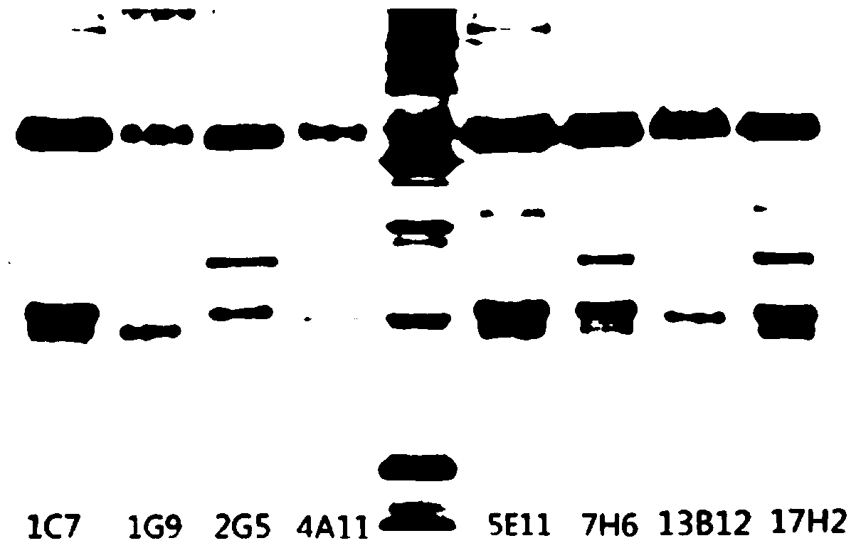 Preparation method of mouse anti-human SAA monoclonal antibody