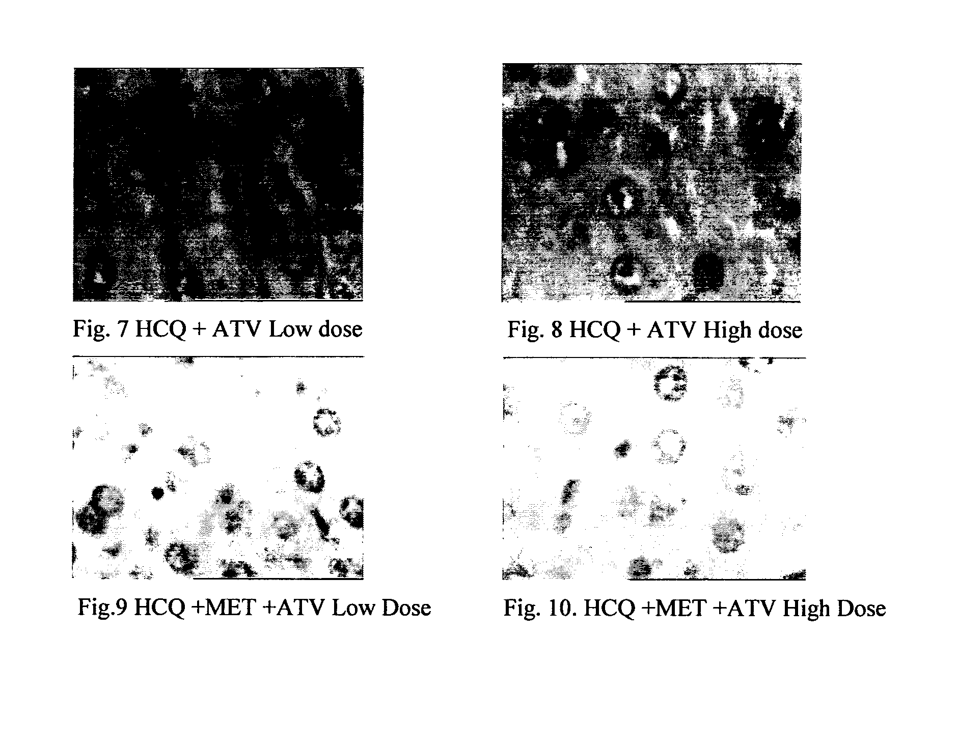 Pharmaceutical compositions for the treatment/prophylaxis of non-alcoholic fatty liver disease