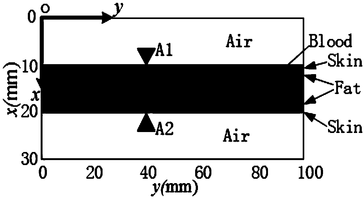 Detection method of blood sugar concentration based on neural network algorithm