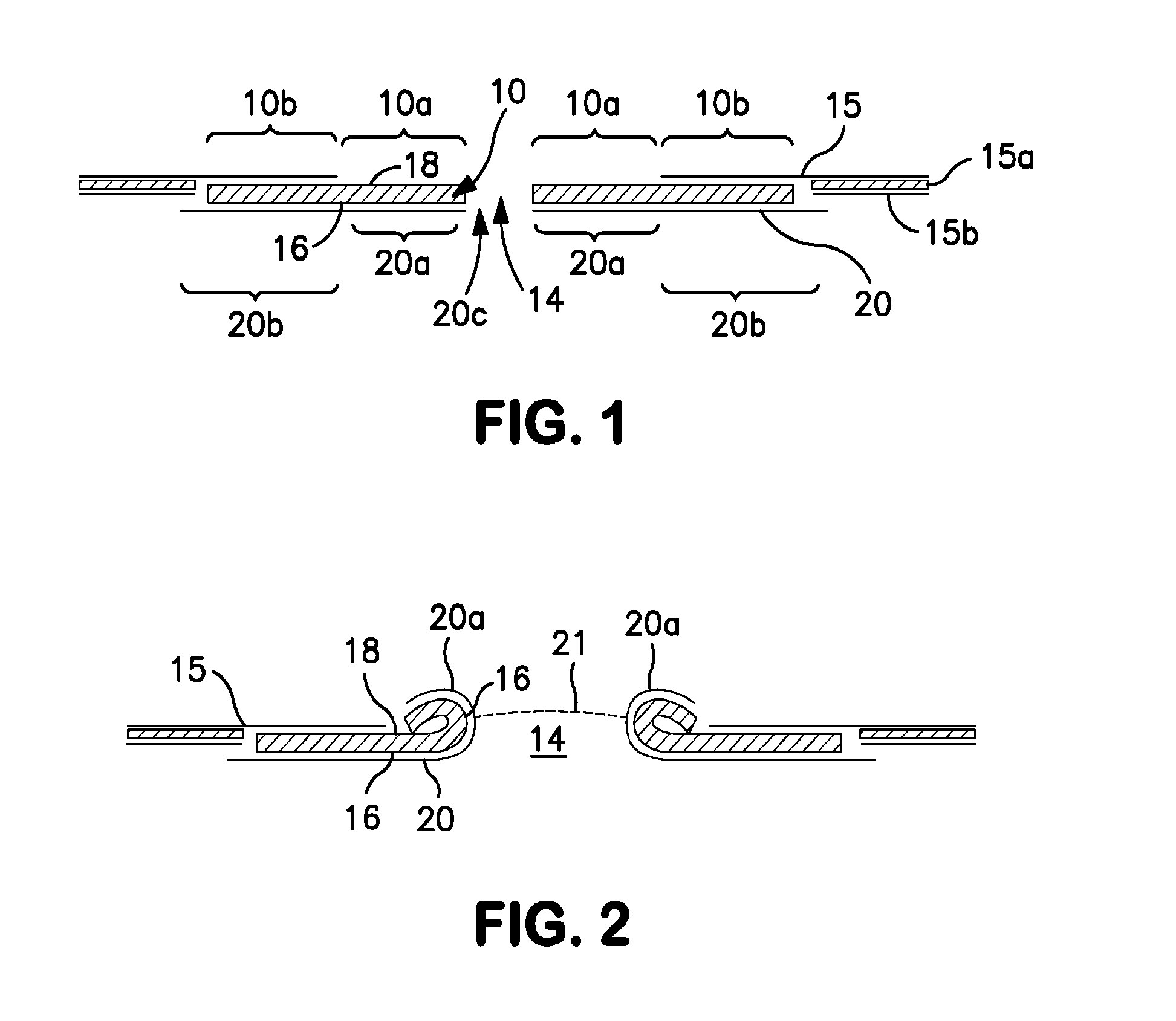 Ostomy appliance with moldable adhesive