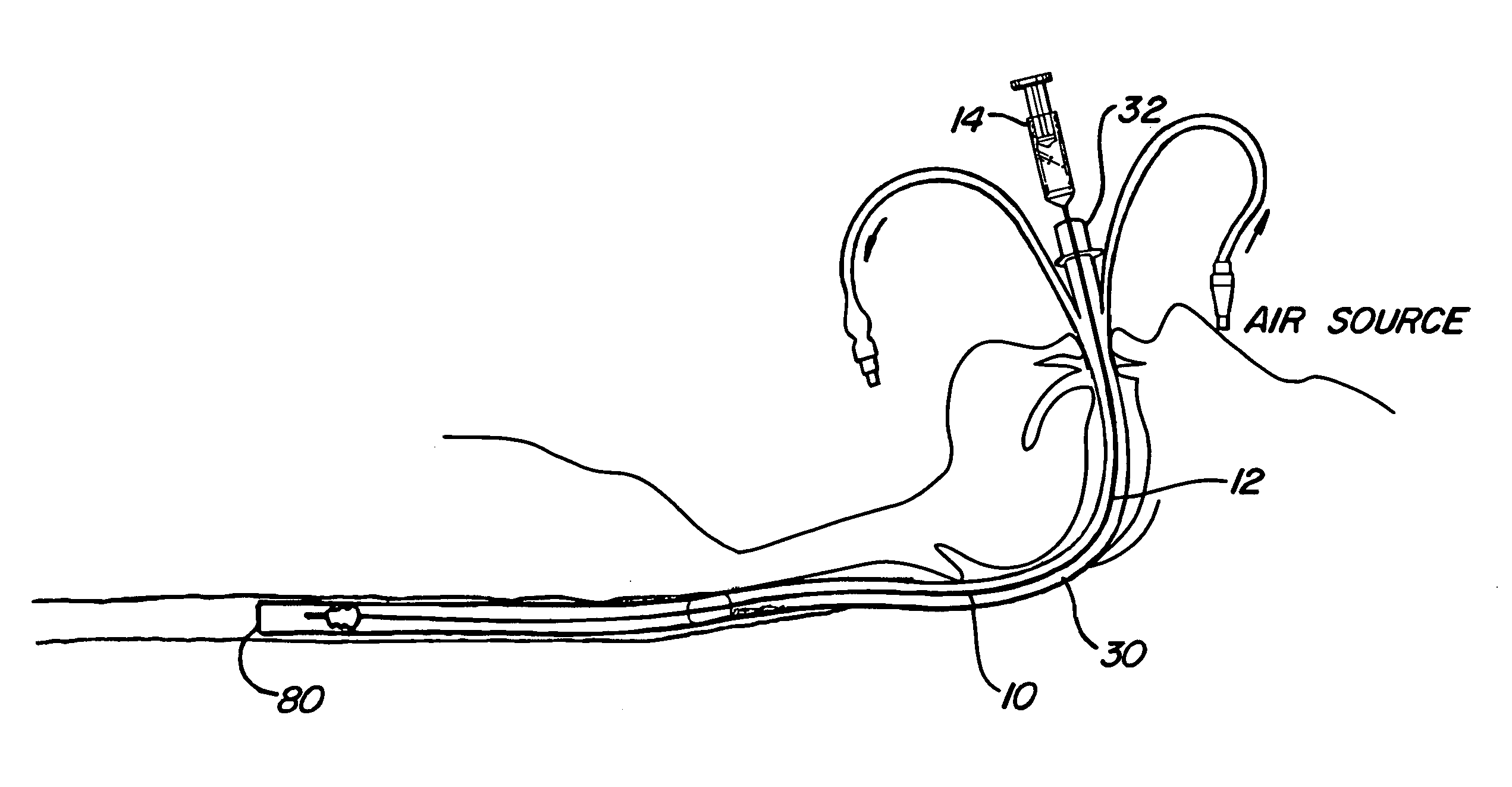 Mucus shaving apparatus for endotracheal tubes