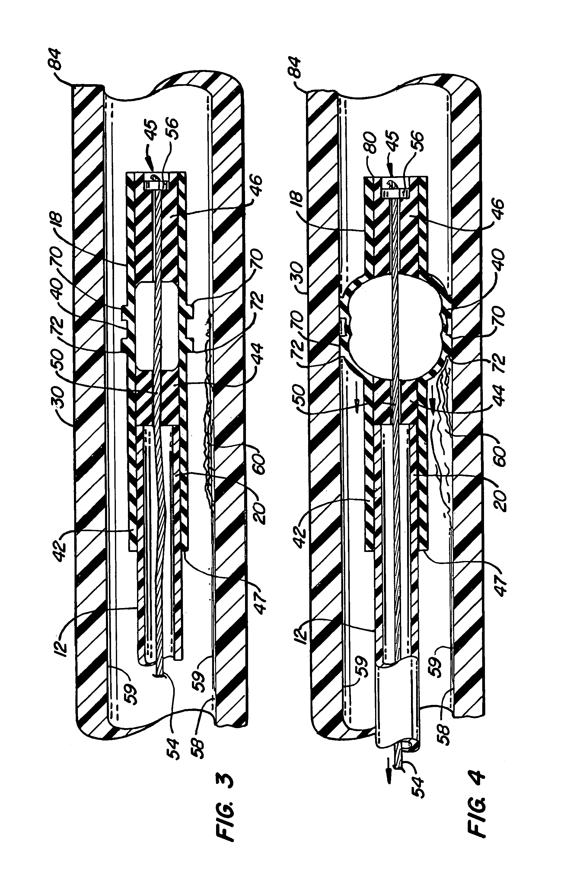 Mucus shaving apparatus for endotracheal tubes