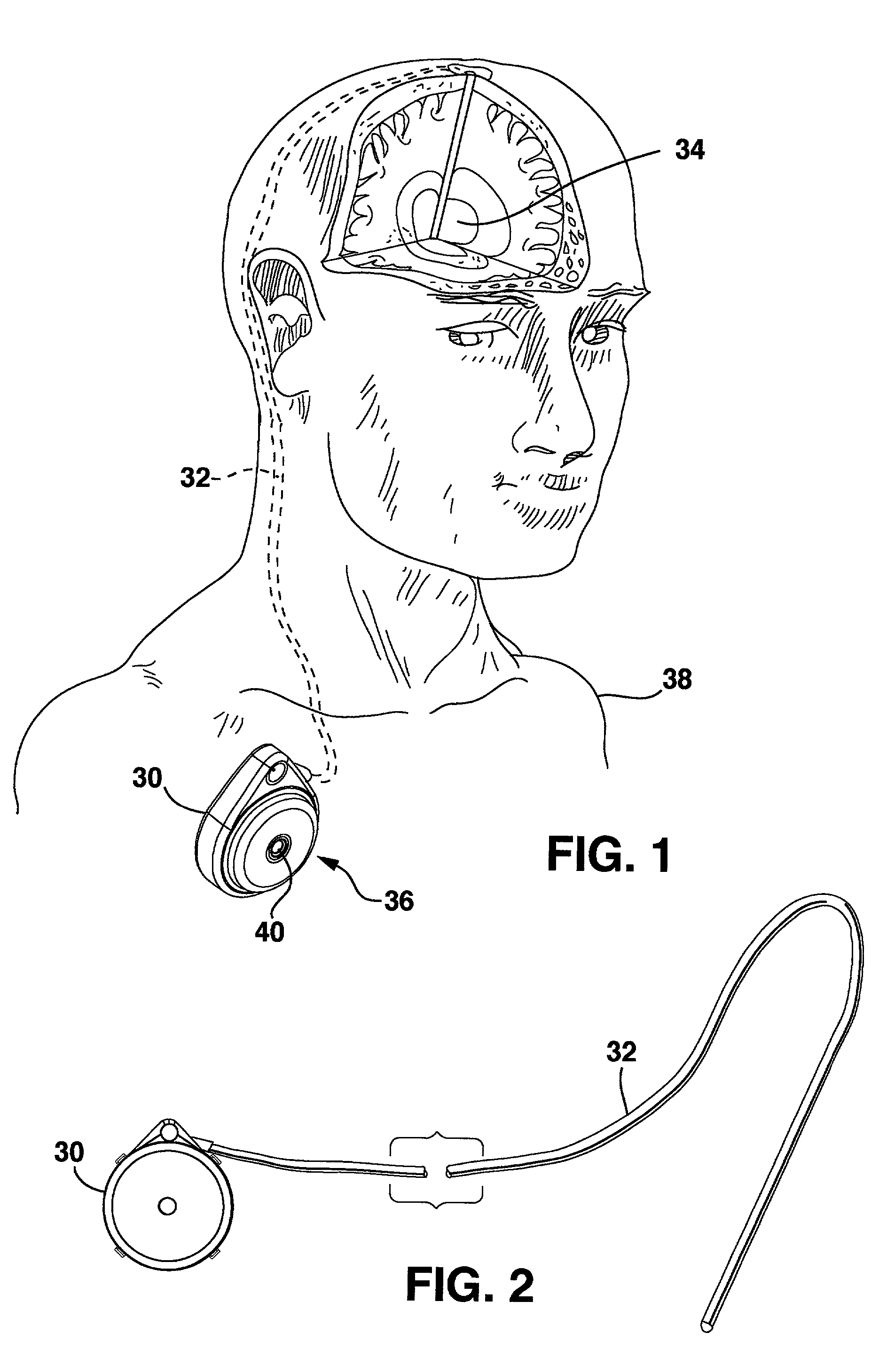 Low profile inlet valve for a piston pump therapeutic substance delivery device