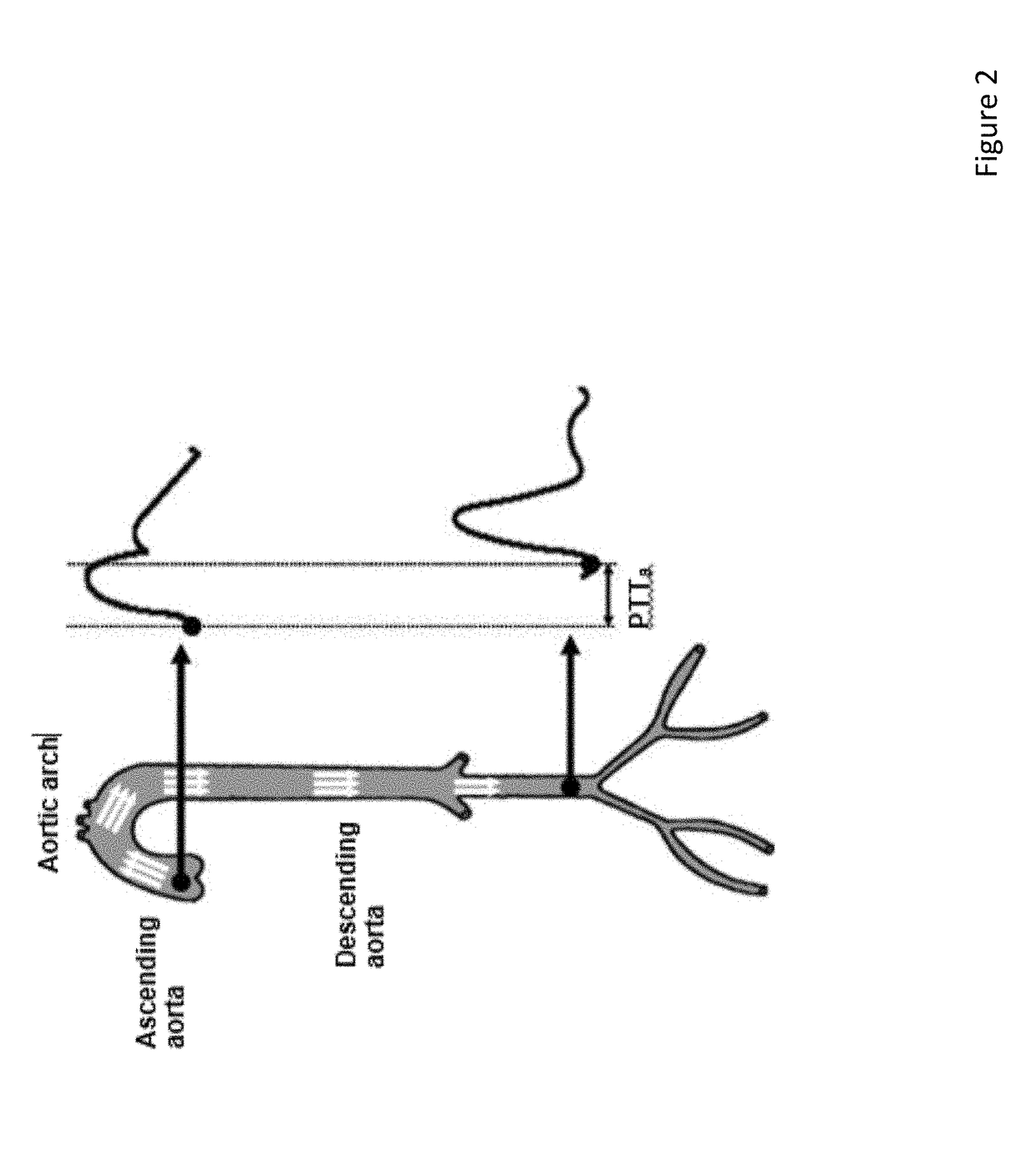 Diabetes and Hypertension Screening by Assessment of Arterial Stiffness and Autonomic Function