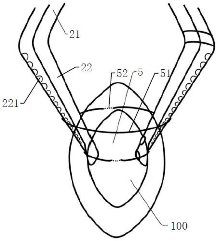 Subcutaneous incision expanding forceps