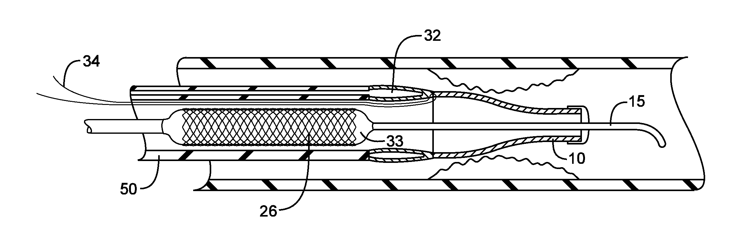 Methods and devices for protecting a passageway in a body when advancing devices through the passageway