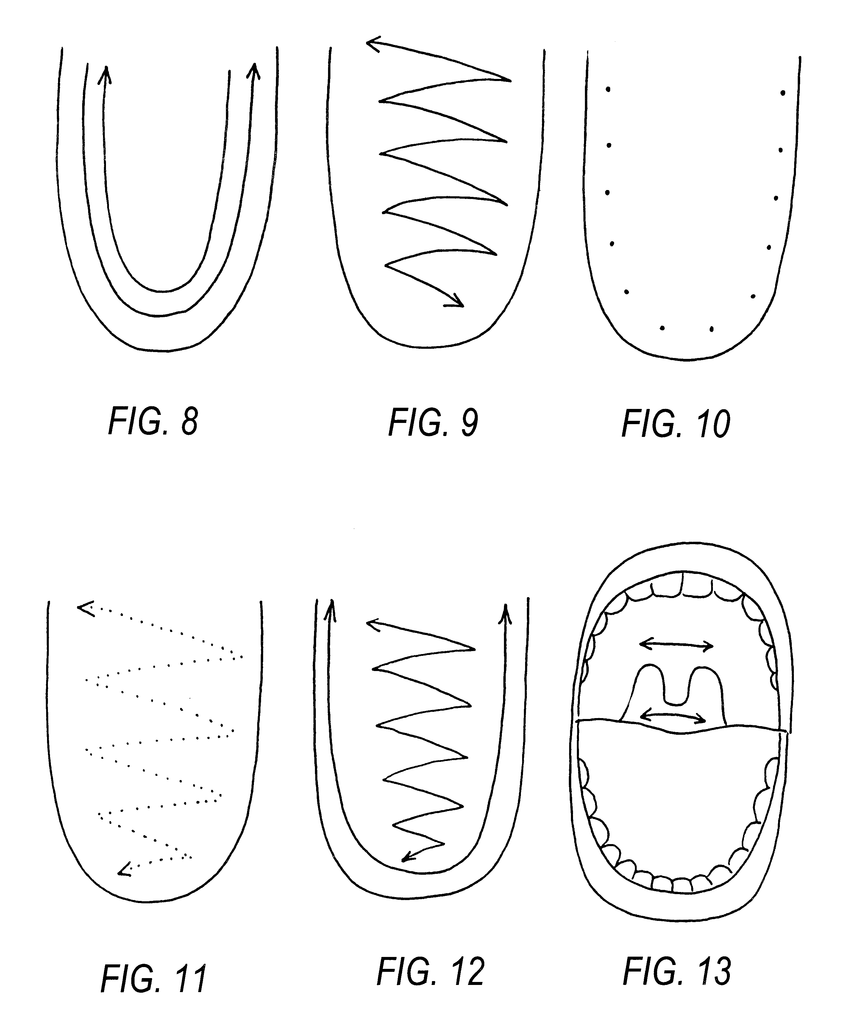 Method of restoring speech functions in patients suffering from various forms of dysarthria, and dysarthria probes