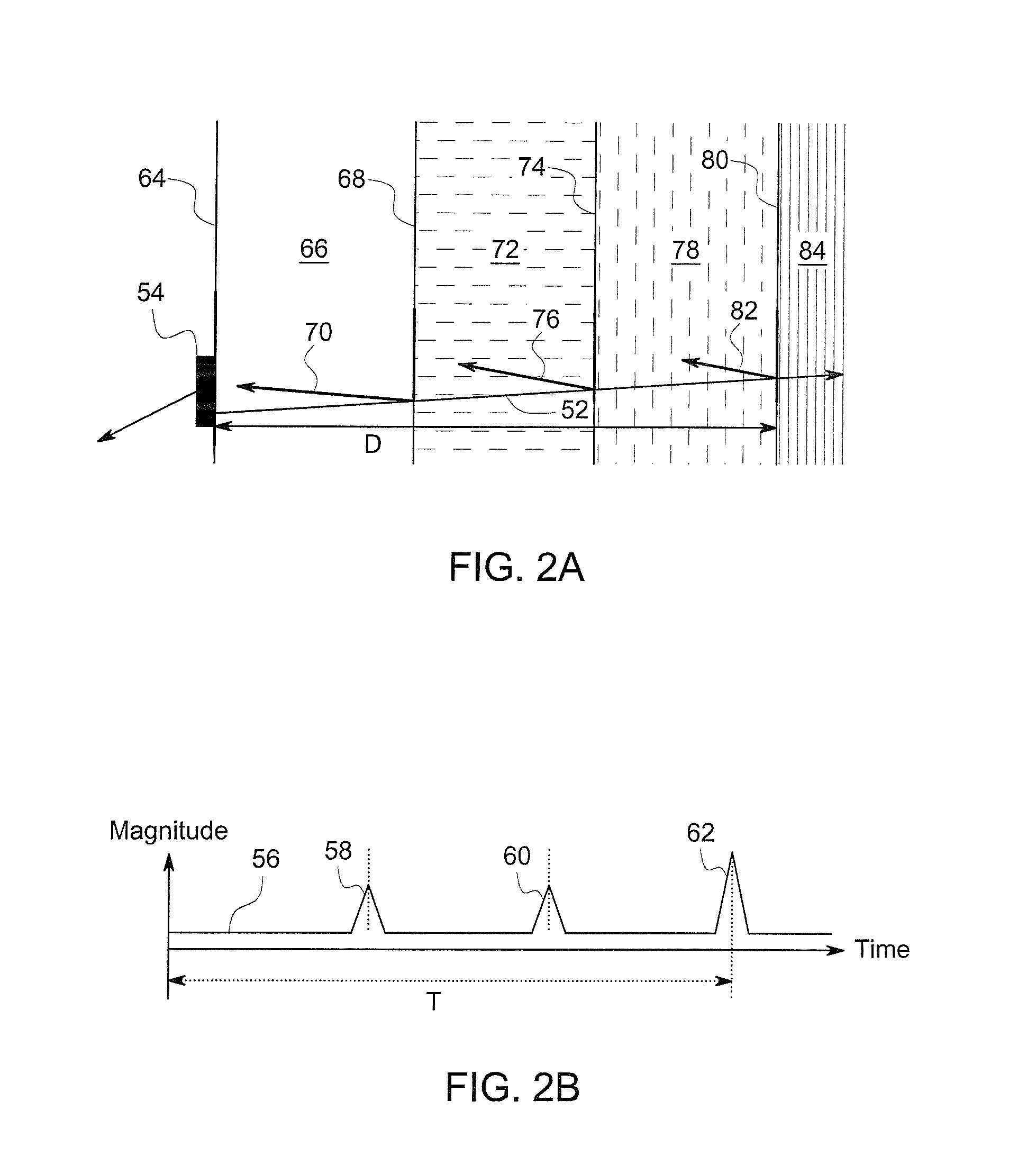 Abdominal Sonar System and Apparatus