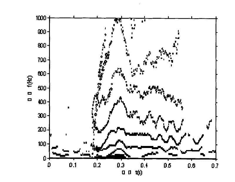 Method for acquiring vocal print picture with refined time-frequency structure