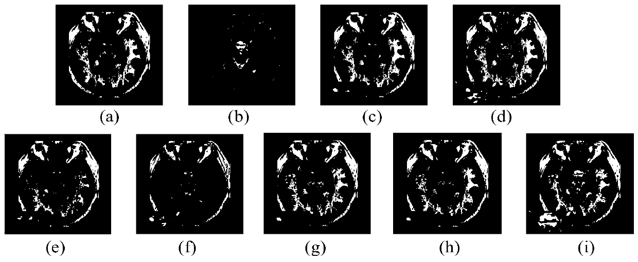 Medical image fusion method based on improved pulse coupling neural network