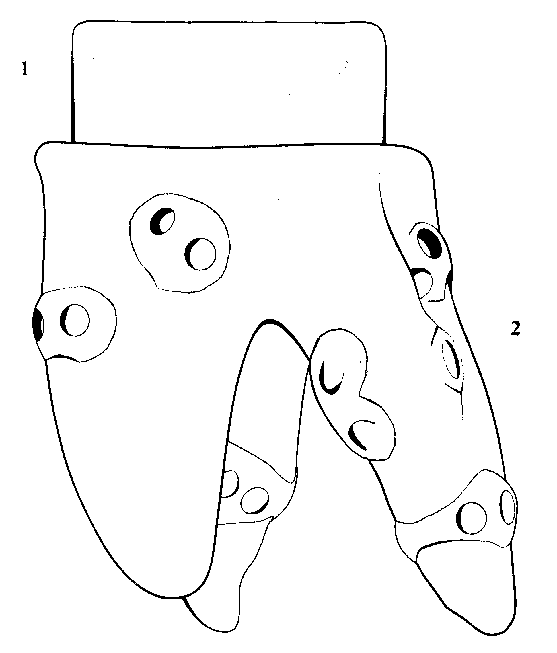 BioRoot(R) anatomic endosseous dental implant