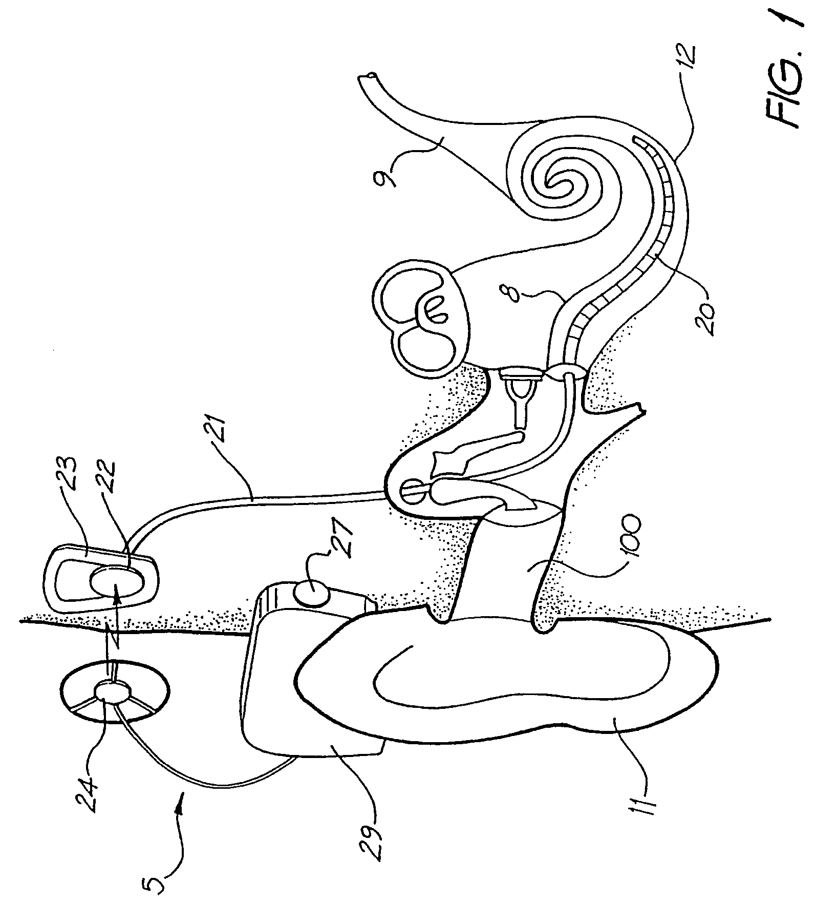 Programmable auditory prosthesis with trainable automatic adaptation to acoustic conditions