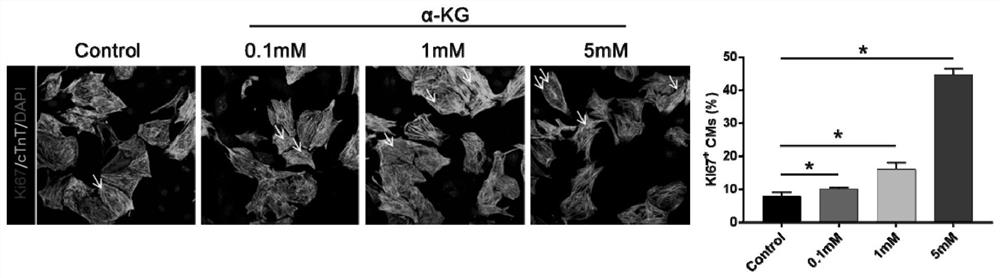 Application of alpha-ketoglutaric acid in preparation of medicine for treating myocardial infarction