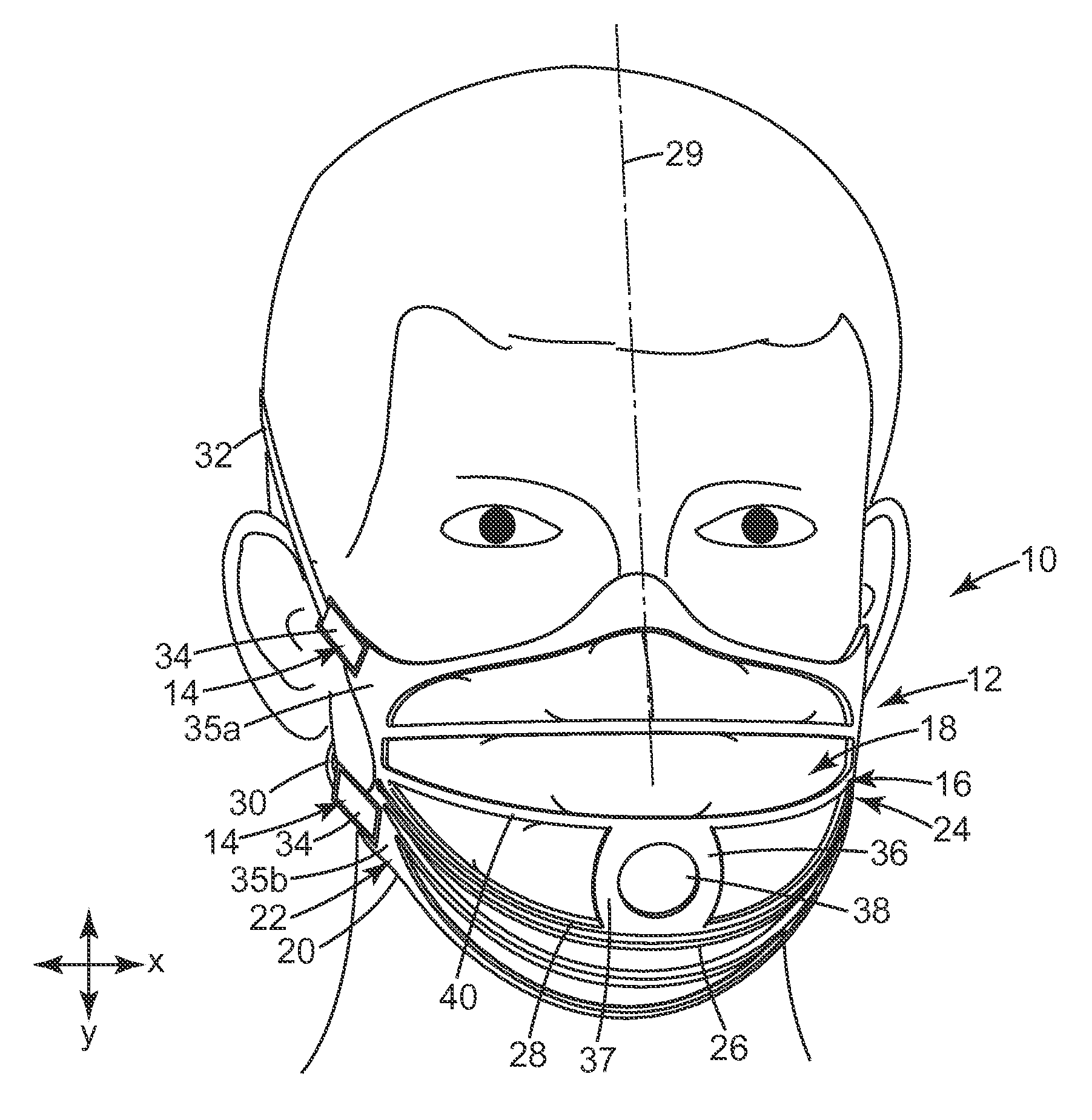 Respirator having dynamic support structure and pleated filtering structure