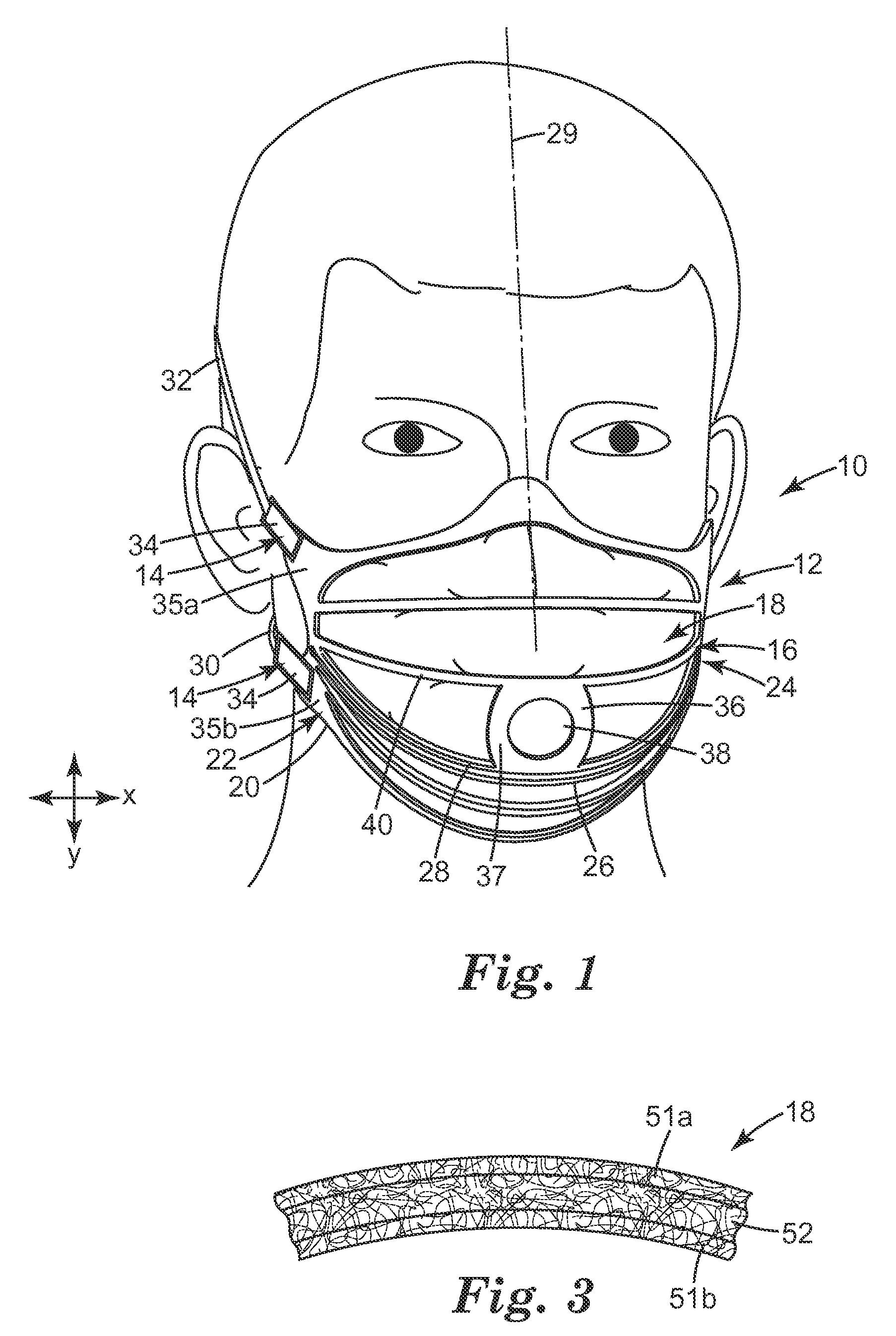 Respirator having dynamic support structure and pleated filtering structure