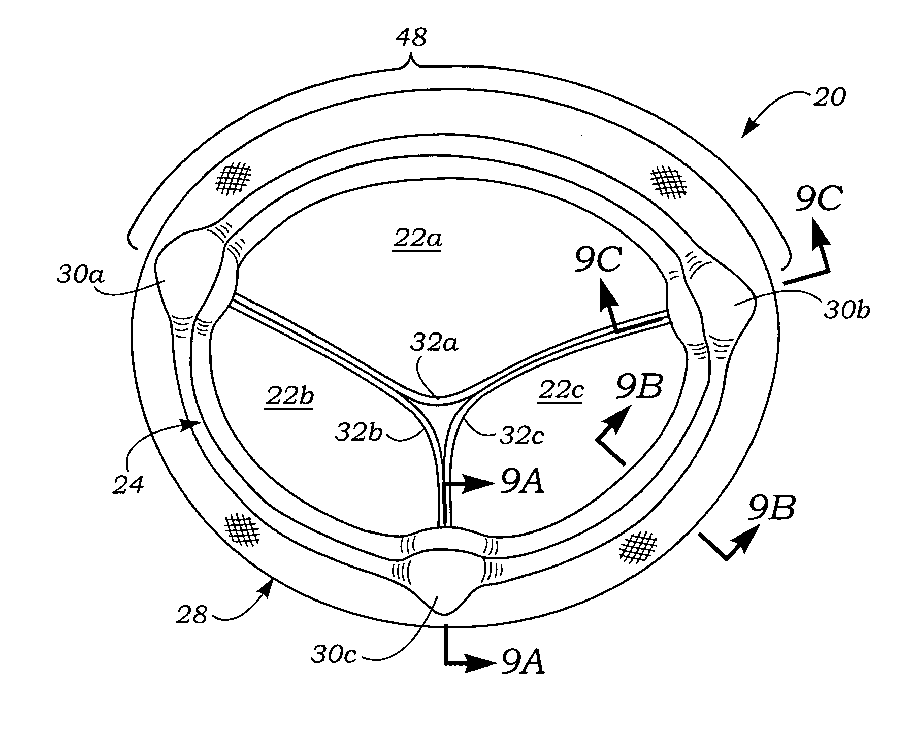 Anatomically approximate prosthetic mitral heart valve